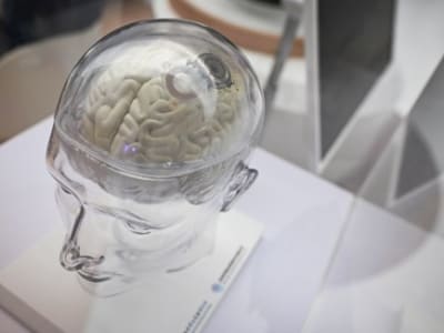 Perkembangan Cepat Teknologi Brain–Computer Interface untuk Membantu Penderita Kelumpuhan di China