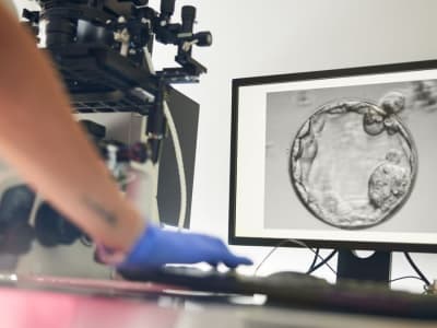 Teknologi AI Temukan Sperma Tersembunyi, Bantu Pasangan Infertil Hamil