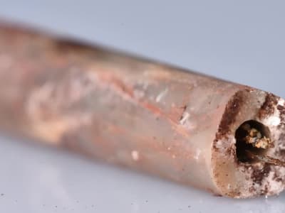 Jarum Akupunktur Baja Berusia 2.000 Tahun Ungkap Kemajuan Dinasti Han