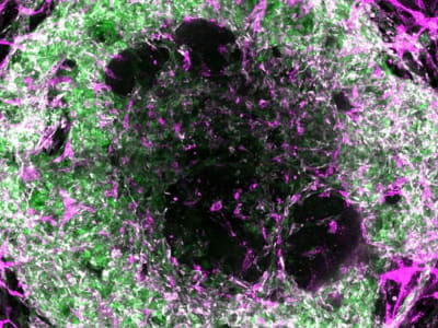 Peneliti Ciptakan Organoid dengan Pembuluh Darah untuk Organ Mini Lebih Sempurna