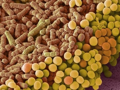 Bakteri Usus Baru Ditemukan Bisa Tingkatkan Efektivitas Terapi Kanker