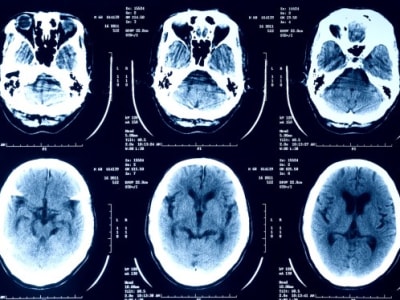 Pencurian Data Besar Episource, Ancaman Keamanan Data Kesehatan di AS