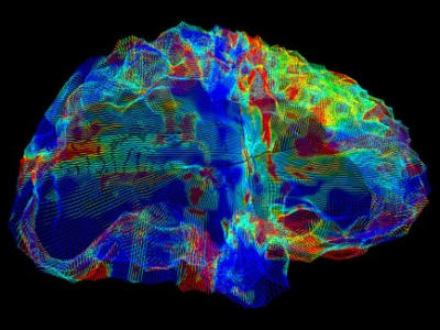 Varian Gen APOE ε4 Sebabkan Risiko Lebih Besar untuk Berbagai Penyakit Otak