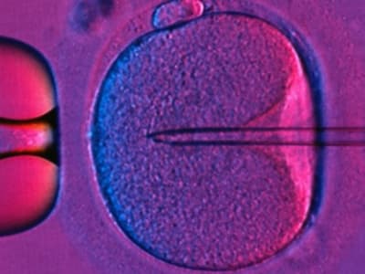Teknik Tiga-DNA: Bayi Sehat Lahir dari Prosedur Mitochondrial Donation di Inggris