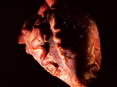 Metode Murah Baru Untuk Menghidupkan Kembali Jantung Anak Donor dan Tingkatkan Transplantasi