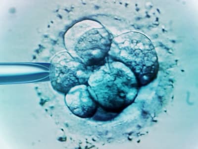 Teknologi IVF DNA Tiga Sumber Cegah Penyakit Mitokondria Berat