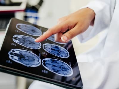 Nanoflowers Inovatif: Harapan Baru untuk Mengatasi Kerusakan Sel Otak