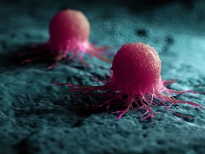 Vaksin Nanopartikel Baru Menjanjikan Perawatan Kanker Personal yang Lebih Efektif