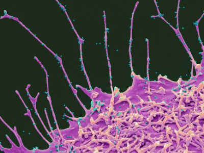 Pandemi COVID-19 Mempercepat Penuaan Otak Tanpa Infeksi Virus