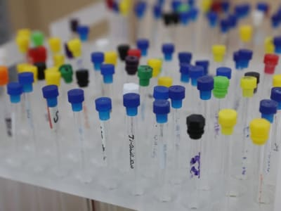 Prosedur Mudah Membuka Peluang Produk Obat Tradisional Hong Kong ke Tiongkok