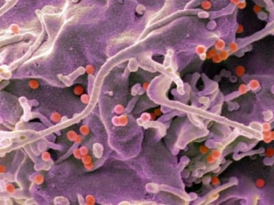 Vaksin mRNA Baru Tunjukkan Respon Kuat Melawan HIV dalam Uji Klinis Awal