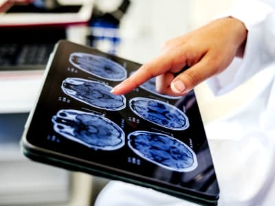 Mengungkap Bahaya Sleep Apnea: Pentingnya Tidur Berkualitas untuk Kesehatan Otak dan Jantung