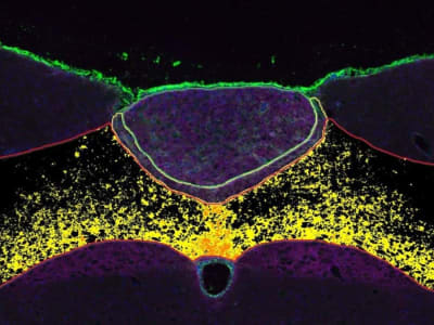 Obat Baru Dari Sel Pendukung Otak Atasi Obesitas Tanpa Efek Samping