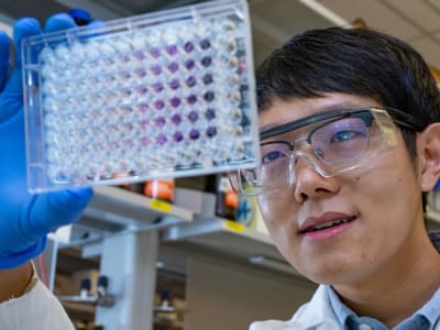 Rahasia Bakteri Lactococcus lactis dalam Meningkatkan Produksi Vitamin K₂