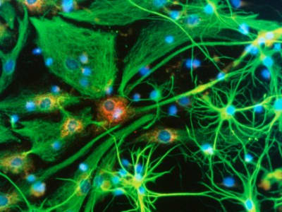 Kemajuan Terobosan CRISPR Mengobati Penyakit Otak Genetik dalam Waktu Dekat