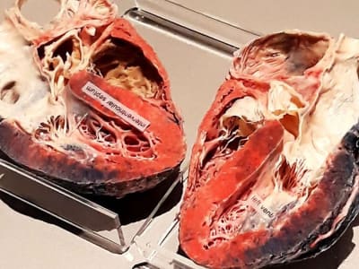 Teknik Baru Cairan Ionik Membuat Organ Transparan Perkaya Ilmu Kedokteran