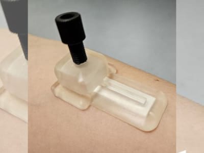 Patch Microneedle Tanpa Darah untuk Pantau Kesehatan dengan Mudah