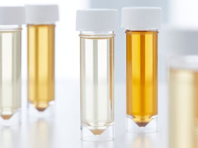 Urin Manusia Diubah Jadi Pupuk Tenaga Surya untuk Pertanian Berkelanjutan