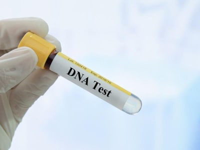 Mengenal Tes DNA dan Progres Hasil Pemeriksaan Ridwan Kamil hingga Kini