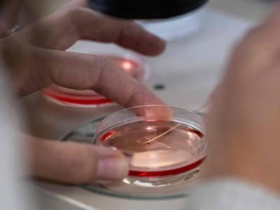 Terobosan Organoid Ginjal 3D Bertahan Lama Buka Peluang Terapi Baru