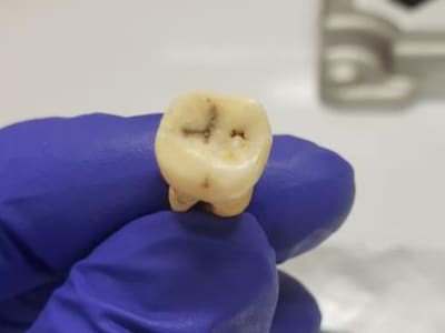 Penemuan Bakteri Penyebab Wabah Justinian di Kota Kuno Jerash