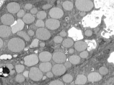 Sel ‘Muntah’ Untuk Cepat Sembuhkan Luka, Tapi Berisiko Kanker