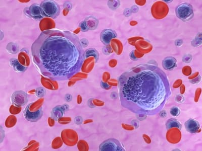 Charm Therapeutics Raih Rp 1.32 triliun ($80 Juta)  untuk Kembangkan Obat Baru Leukemia AML