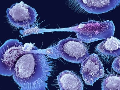 Sel Imun Baru di Lemak Memicu Peradangan pada Penuaan