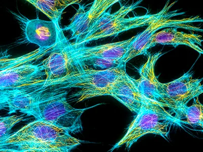 Penemuan Tubulin Pada Sel Asgard Mengungkap Asal Usul Sel Eukariotik