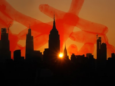 Penyakit Legionnaire’s dan Perubahan Iklim: Ancaman Baru di Tengah Kota Besar