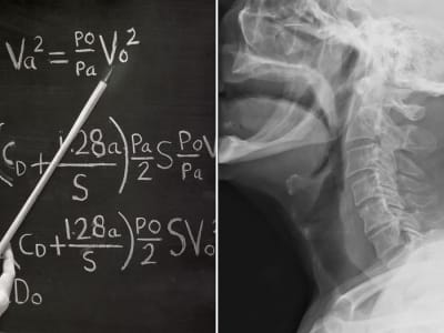 Model Matematika Baru Membantu Mengatasi Masalah Sulit Menelan dengan Akurat