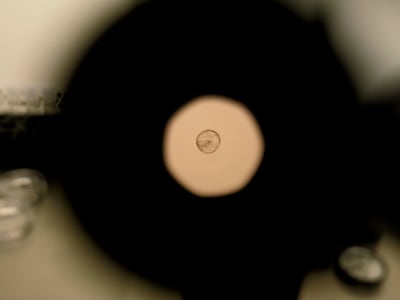 Mengungkap Rahasia Proses Implantasi Embrio Manusia Lewat Rahim Buatan