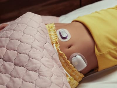 Insulet Ciptakan Warna Oranye Omnipod Mango untuk Lawan Dominasi Biru di Alat Diabetes