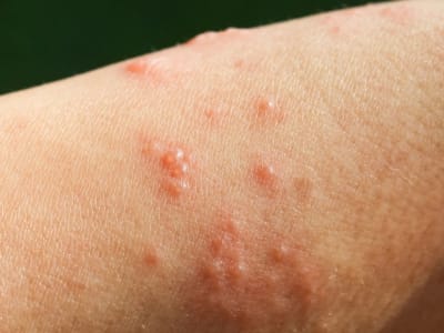 Sanofi Tingkatkan Investasi Rp 10.28 triliun ($625 Juta)  Dukung Terobosan Kesehatan Digital dan Biotek