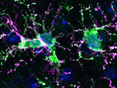 Terobosan Penggantian Mikroglia Bisa Redakan Penyakit Otak Serius