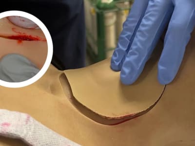 Teknologi Cetak 3D Baru Ciptakan Jaringan Manusia Realistis untuk Pelatihan Bedah