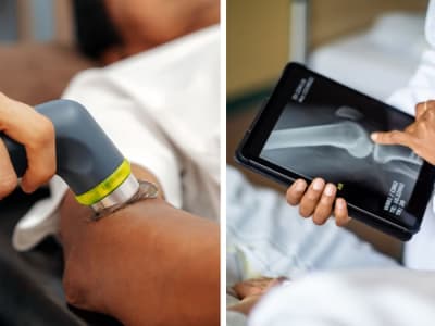 Alat Cetak Tulang Baru: Solusi Murah dan Cepat untuk Penyembuhan Patah Tulang