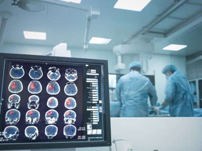 Mengapa Saham Masimo Masih Diremehkan Meski Bisnisnya Kuat dan Stabil