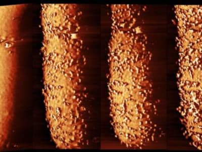 Bagaimana Antibiotik Polymyxin B Menembus Pertahanan Kuat Bakteri Gram-Negatif