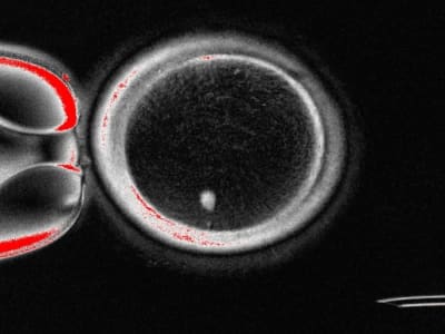 Terobosan Mitomeiosis Ubah Sel Kulit Jadi Sel Telur untuk Atasi Infertilitas