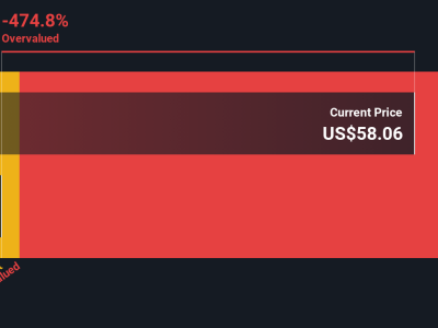 Globus Medical: Inovasi Robotik dan Ekspansi Pasar, Harga Saham Dinilai Terlalu Rendah