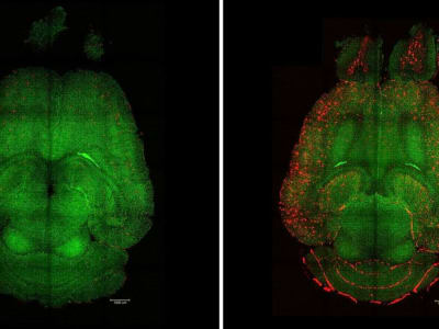 Terobosan Nanoteknologi: Supramolecular Drugs Pulihkan Otak Alzheimer pada Tikus