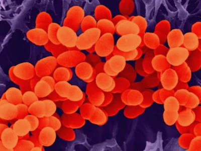 Krisis Resistensi Antibiotik: Dunia Terancam Kekurangan Obat Baru dan Inovasi