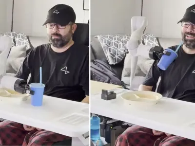 Neuralink Tembus Batas Baru: Pasien ALS Kendalikan Robot dengan Pikiran