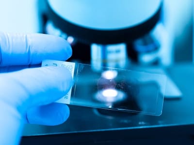 Tubulis Dapat Dana 361 Juta Dolar untuk Kembangkan Terapi Kanker Baru