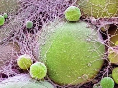 Mutasi Gen MC4R Sebabkan Obesitas Tapi Turunkan Risiko Penyakit Jantung