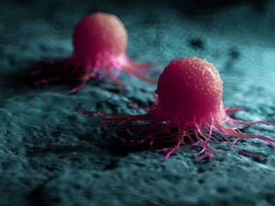 Penemuan Enzim Penguat Kanker Prostat Buka Jalan Terapi Baru