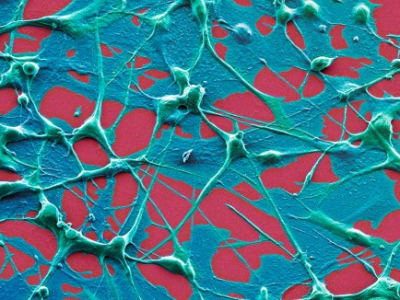 Vaksin mRNA COVID-19 Ternyata Bisa Perpanjang Hidup Pasien Kanker