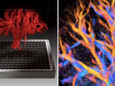 Ultrasound 4D Baru Tampilkan Aliran Darah Organ dengan Detail Mikro