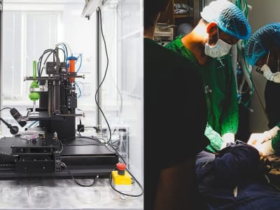 Robot Bioprinter Mini Terinspirasi Belalai Gajah Bantu Operasi Pita Suara